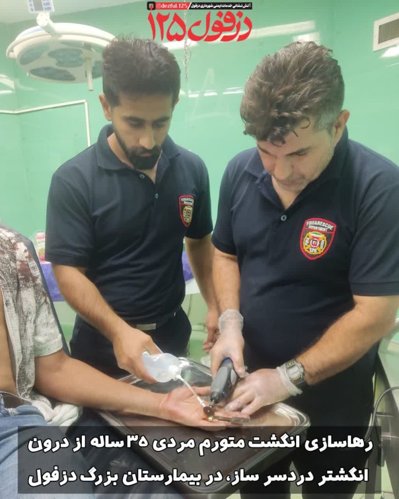 رهاسازی انگشت متورم مردی ۳۵ ساله از درون انگشتر دردسر ساز، در بیمارستان بزرگ‌ دزفول